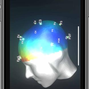 BM App - Featured Mobile - EEG Visualization
