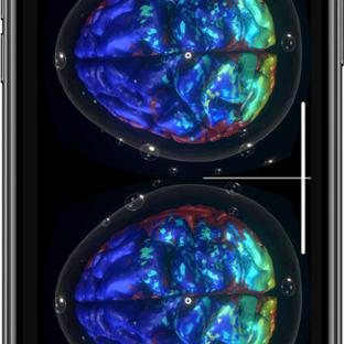 BM App - Featured Mobile - Google glass Brain Cortical Activity