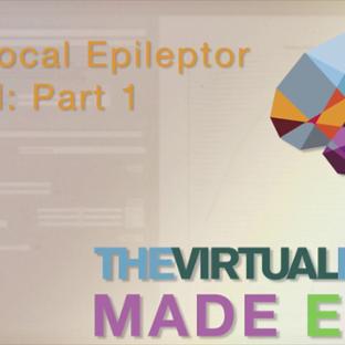 Thumb - TVB Made Easy: The Local Epileptor: Part 1
