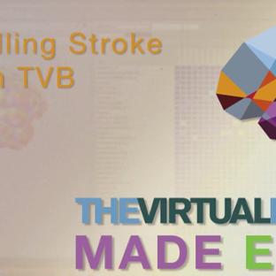 Thumb - TVB Made Easy: Modelling Strokes within TVB