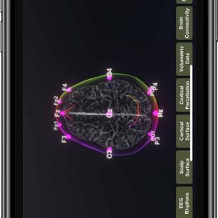 BM App - Featured Mobile - EEG channels