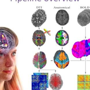 An automated pipeline for constructing personalized virtual brains from multimodal neuroimaging data