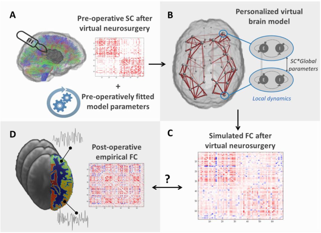 tumor_resection_brain_modelling.jpg