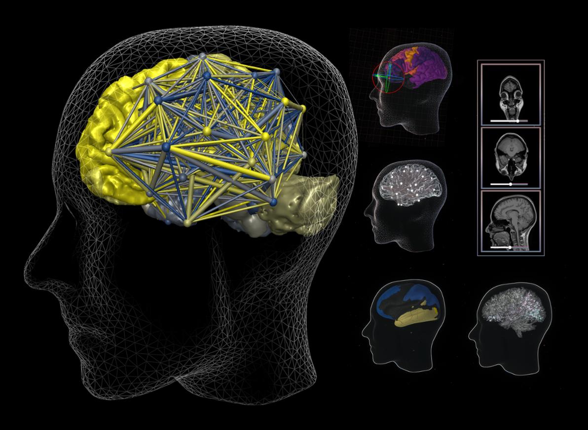 Illustration - Multimodal Brain - black back